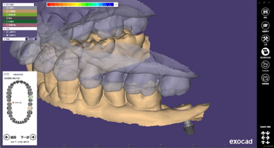 数智鼎植 | 宁波鼎植口腔医院盛大开业，科技赋能口腔诊疗新维度
