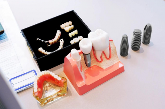 数智鼎植 | 宁波鼎植口腔医院盛大开业，科技赋能口腔诊疗新维度